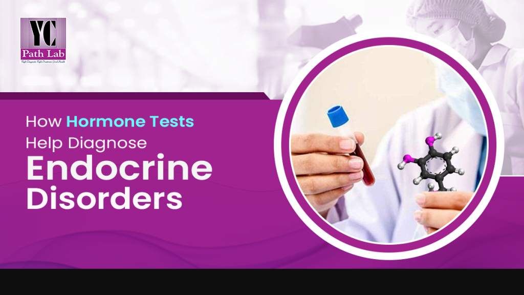 best hormone tests in Karnal