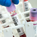 Diabetic Sugar Profile Extended
