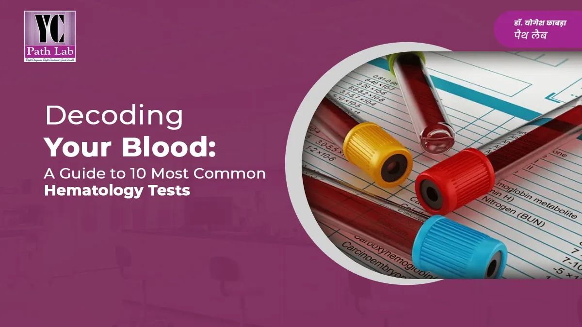 Decoding Your Blood: A Guide to 10 Common Hematology Tests